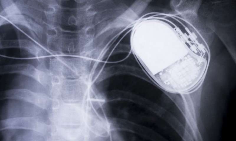 A fine-tuned laser welds more effectively