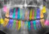 Taking the guesswork out of dental care with artificial intelligence