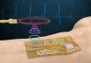 Engineers fabricate a chip-free, wireless, electronic ‘skin’